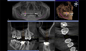 Eugene dentist | 3D imaging | Dr Work